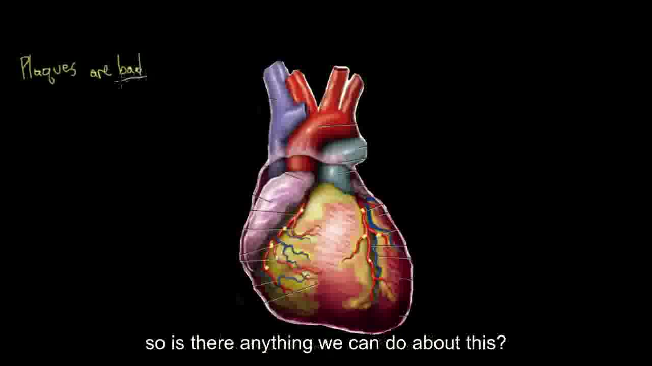 【搬运KhanAcademy】循环系统疾病——Risk factors for coronary artery disease哔哩哔哩bilibili