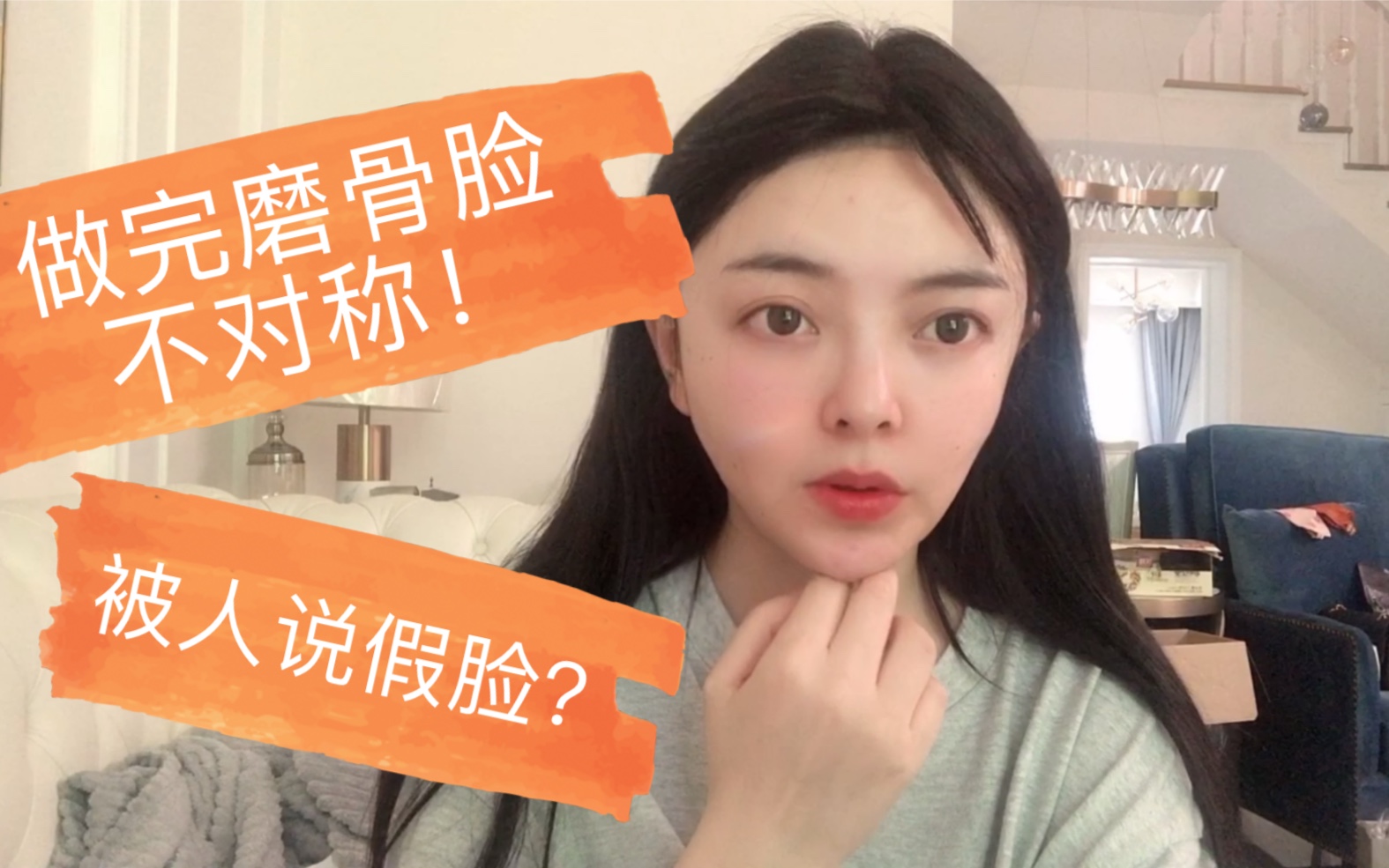 削骨后被人说假脸?颧骨颧弓,下颌角术后一年!_哔哩哔哩_bilibili