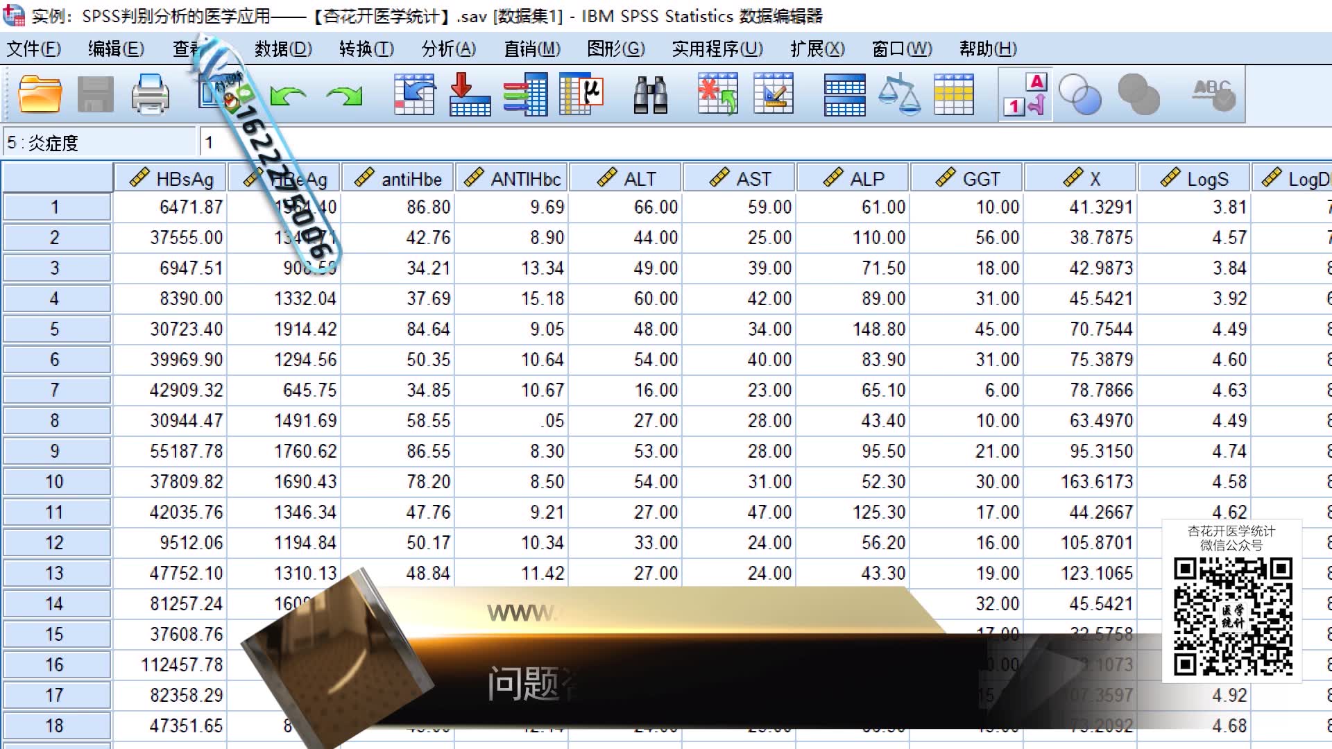 [图]SPSS判别分析在SPSS软件中的操作节结果解读视频教程——【杏花开医学统计】