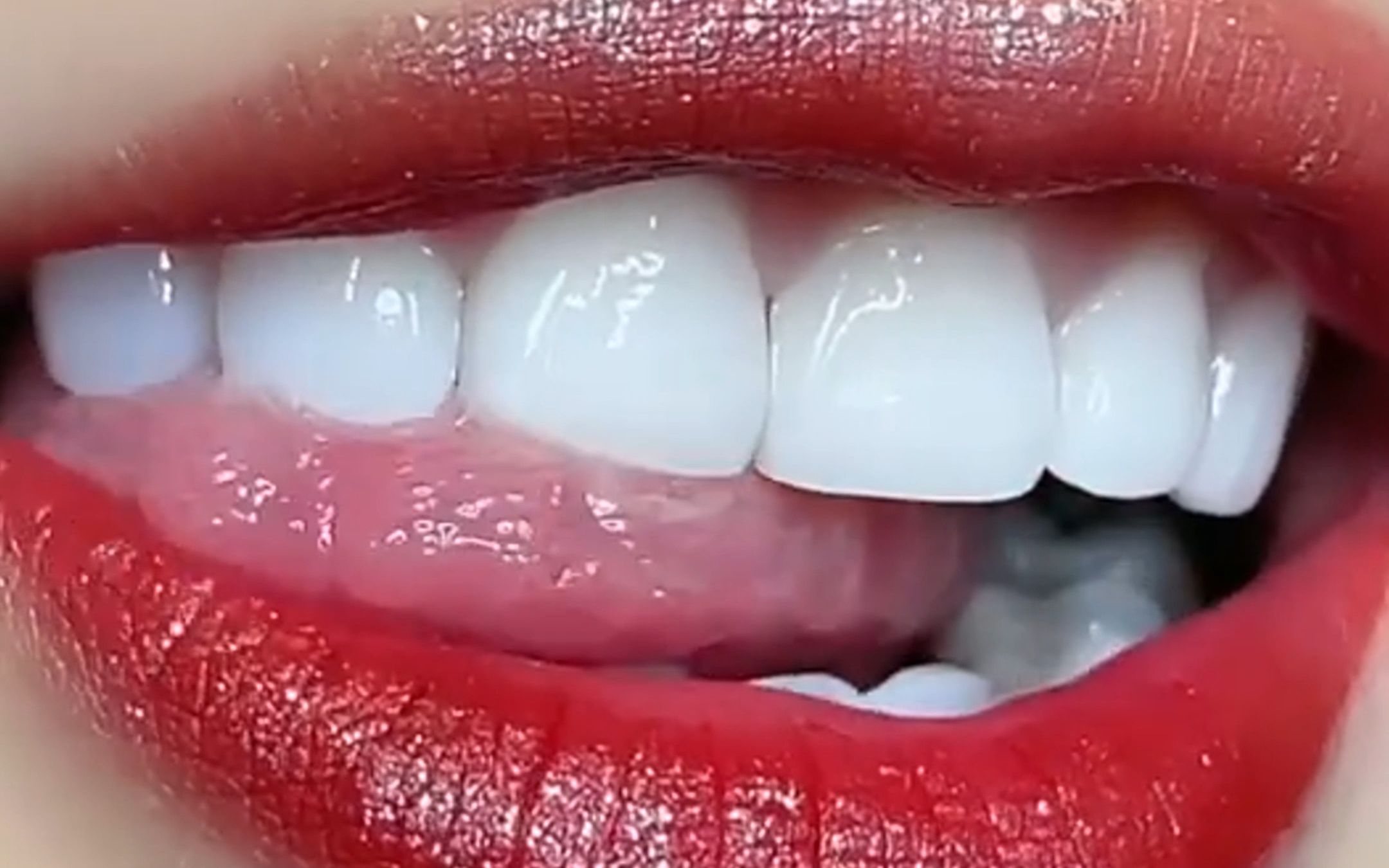 唇红齿白,我是真羡慕了