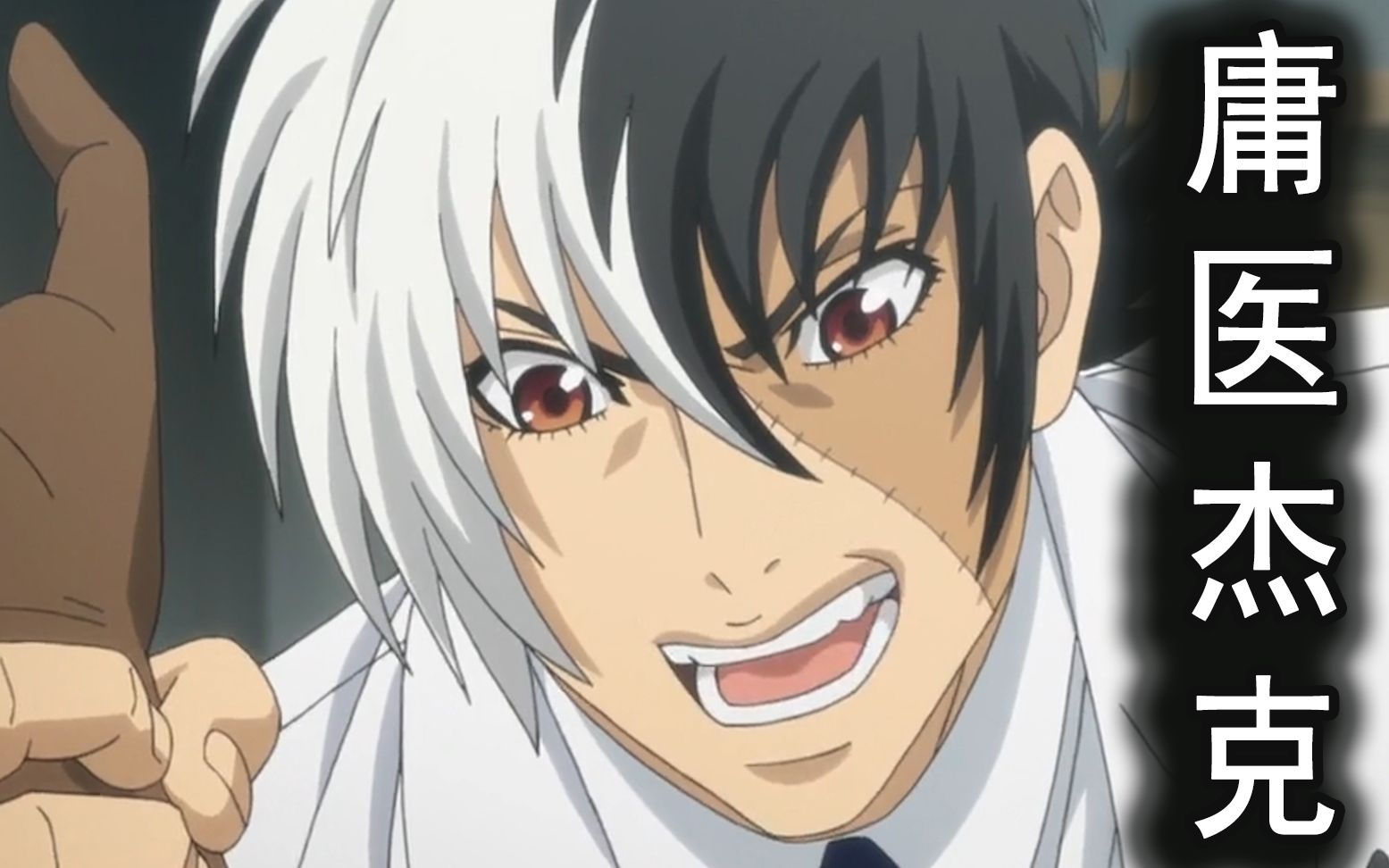 好友患无痛症,被截肢都没感觉,怪医黑杰克扮演庸医套出内幕