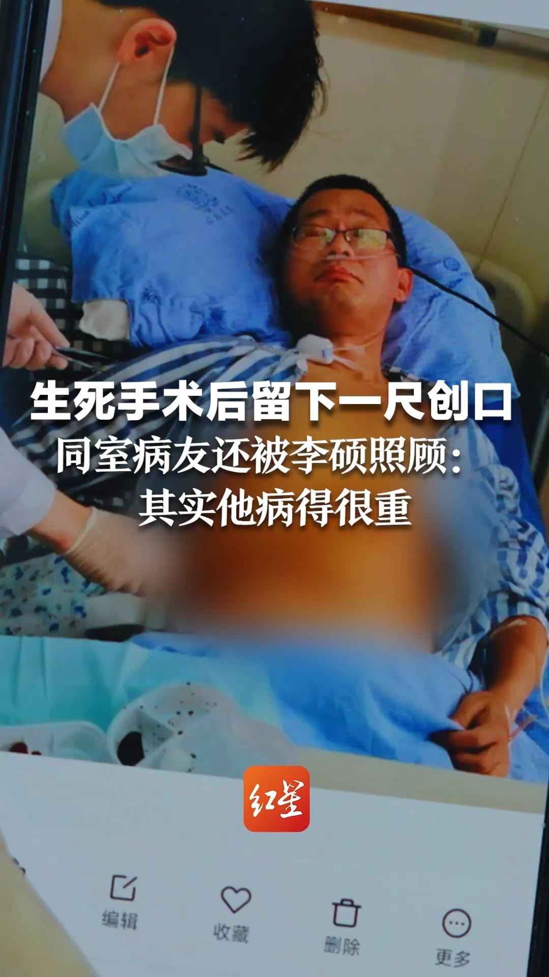 记录历史学家李硕遇癌1年⑤生死手术后留下一尺创口,同室病友还被李硕照顾:其实他病得很重哔哩哔哩bilibili