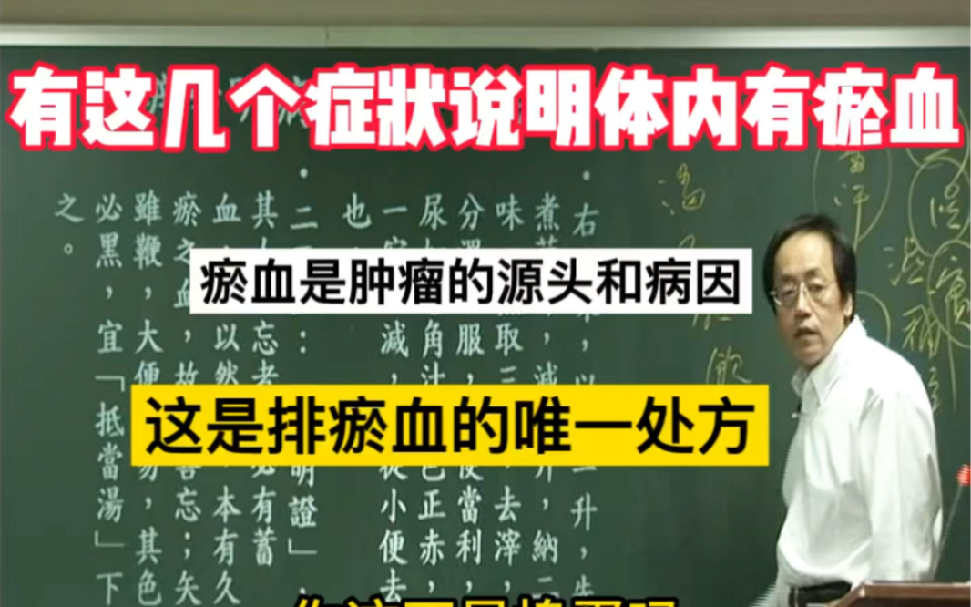 有这几种症状说明体内有瘀血,瘀血是肿瘤的病源和主因,这是排瘀血唯一的处方哔哩哔哩bilibili