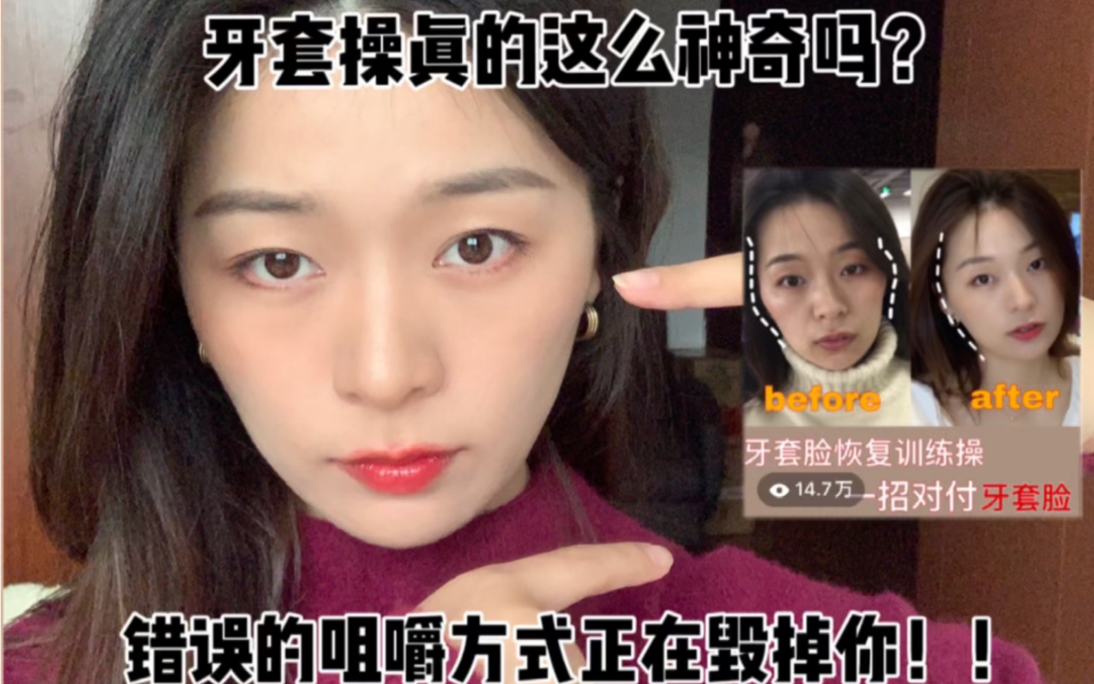 太阳穴凹陷牙套脸牙套操错误的咀嚼方式正在毁掉你