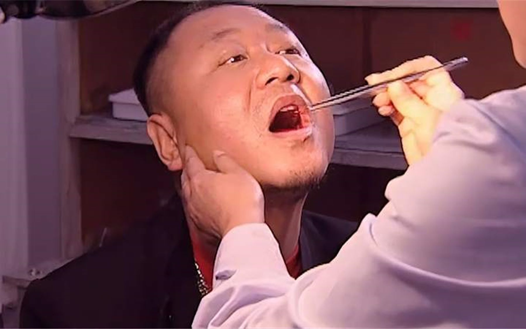 彪哥口吞灯泡,被医生取出来,彪哥还觉得是嘴小了