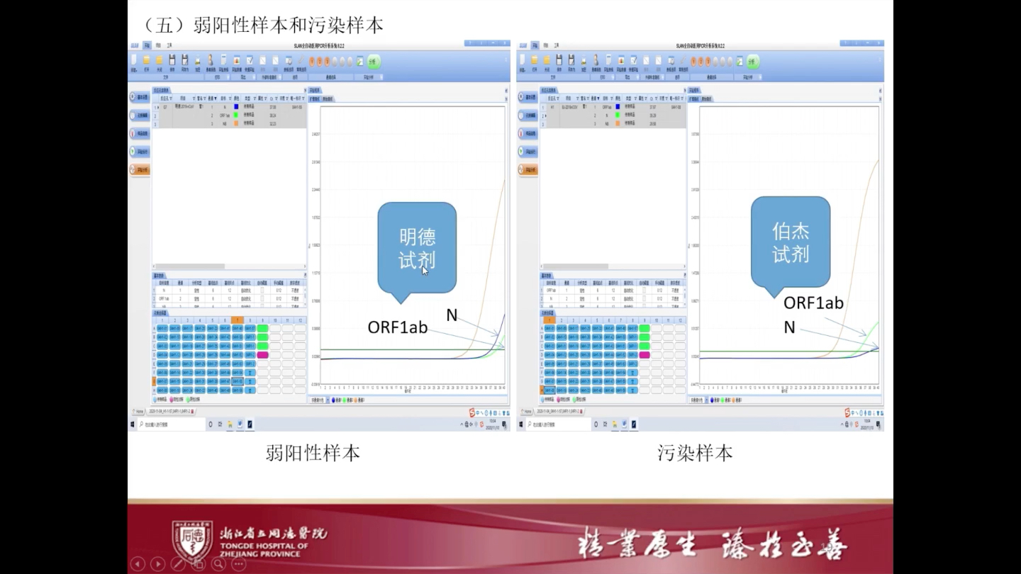 03张永乐新冠核酸检测结果解读案例分享哔哩哔哩bilibili