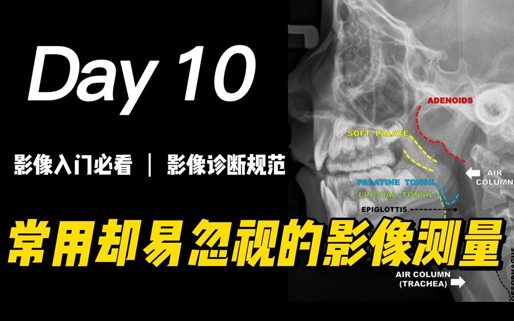 影像诊断规范:常用的影像测量 | 垂体、腺样体肥大、心胸比、肺结节等、医学影像学、医学影像技术、放射科、影像医学与核医学、临床医学、DR、CT、...