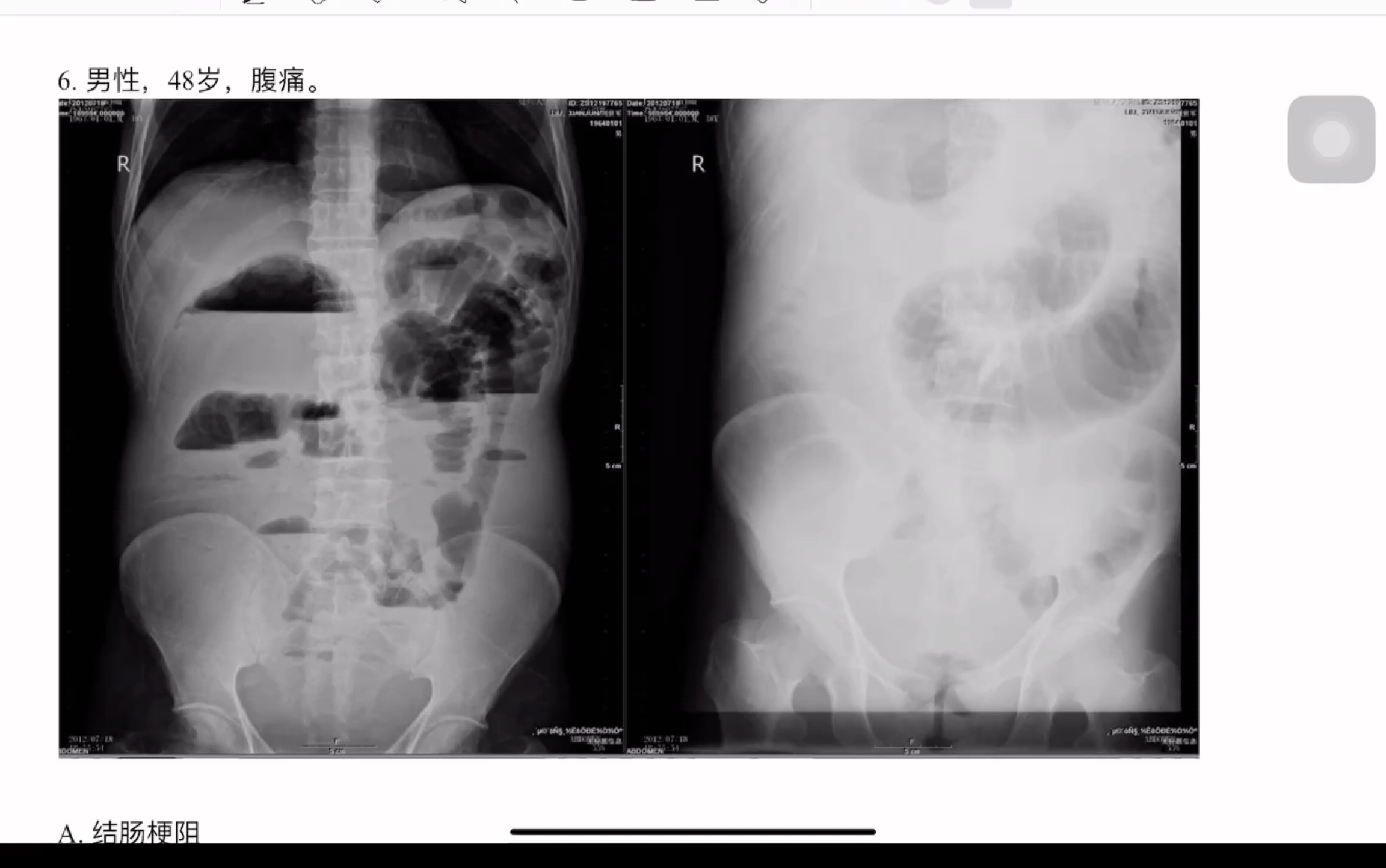 医学影像读片执业医师第一站、技师上岗第四站及规培出站考可看哔哩哔哩bilibili