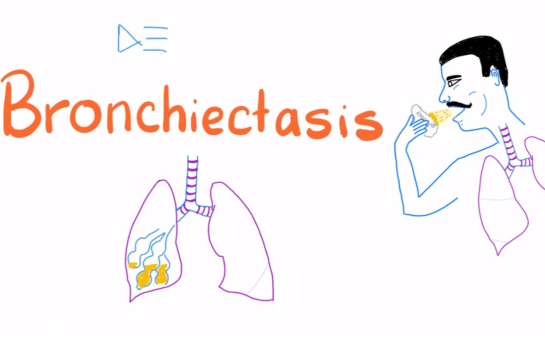 超有趣理解和记忆支气管扩张bronchiectasis