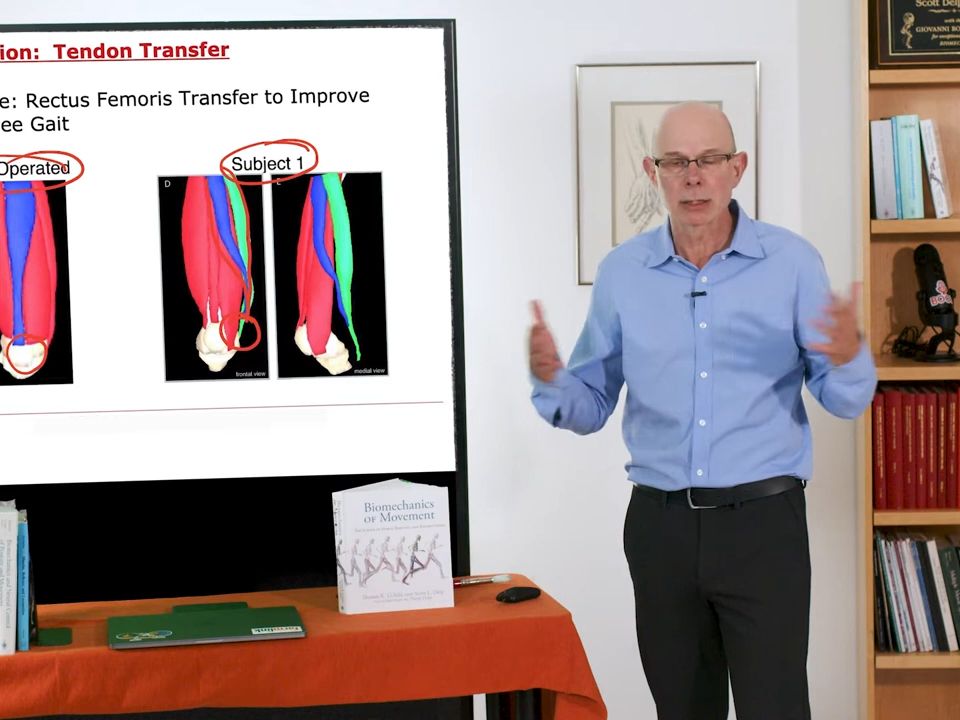 运动生物力学_第6.3讲-利用肌肉骨骼几何设计外科医生