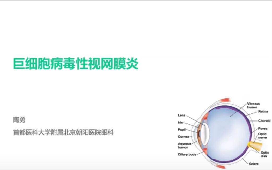 巨细胞病毒性视网膜炎——陶勇(首都医科大学附属北京朝阳医院眼科)哔哩哔哩bilibili