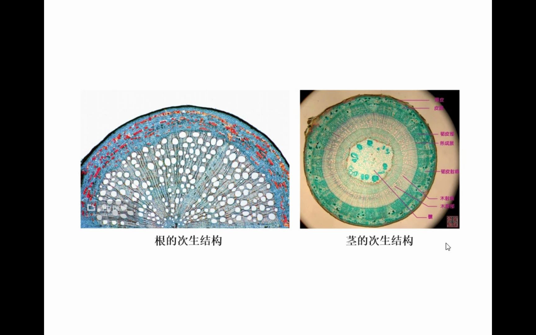 答疑——根和茎结构的区别哔哩哔哩bilibili