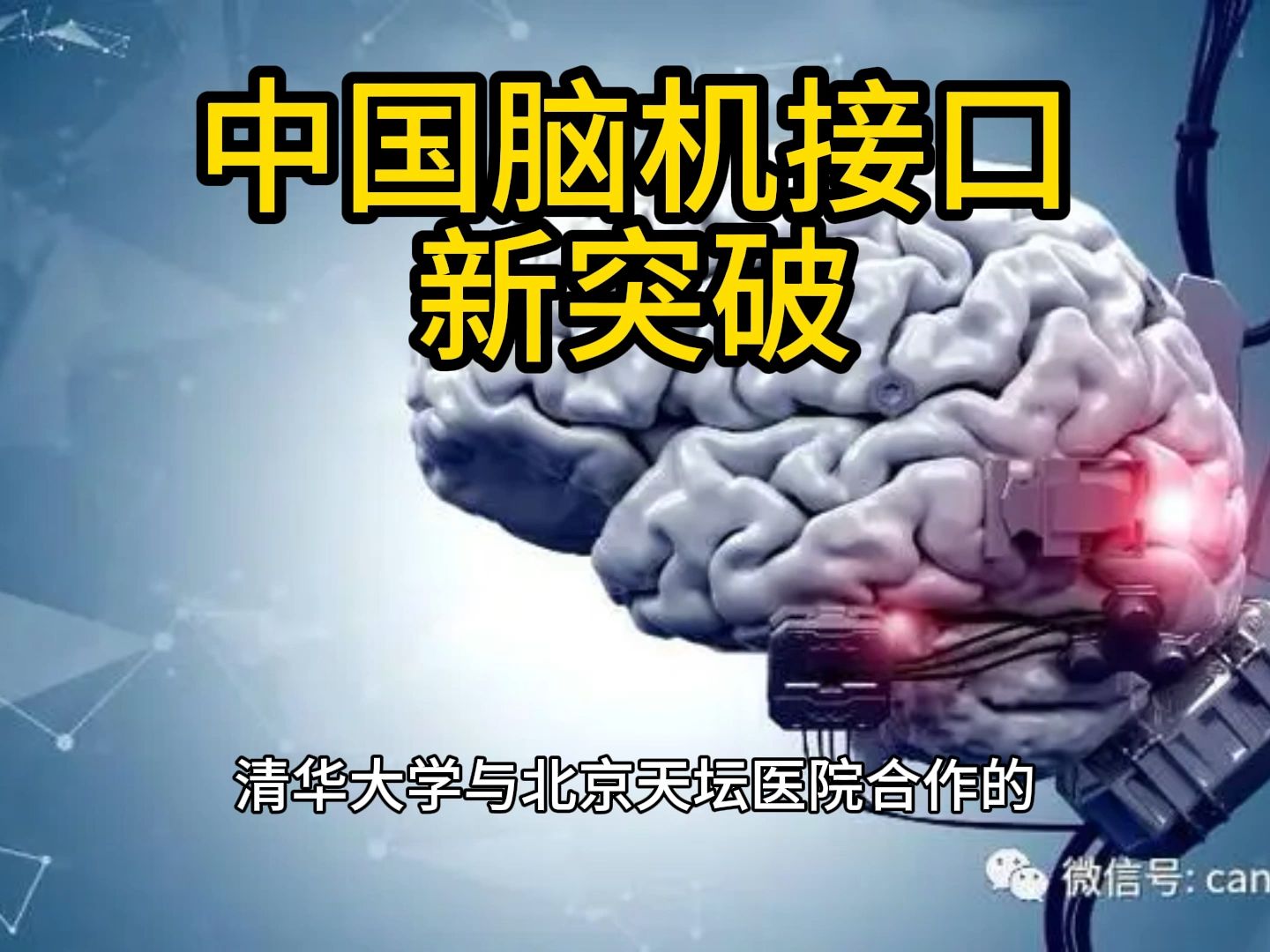 中国脑机接口新突破