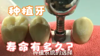 种植牙真的能用一辈子吗？想与种植牙共度余生，这些功课不能少