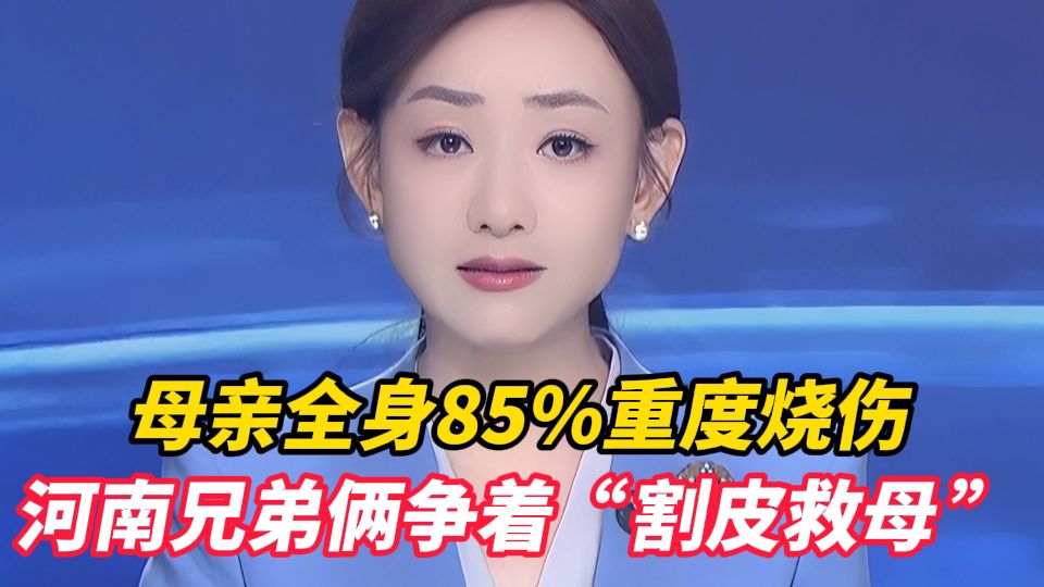 母亲全身85%重度烧伤，河南兄弟俩争着“割皮救母”