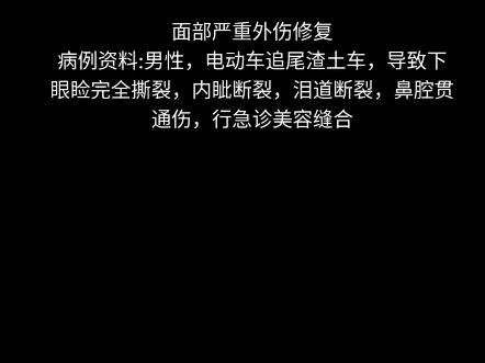 整形美容小手术美容缝合:眼科,耳鼻喉科轮流会诊,缝了三个小时,快吐了,时间太长过程没法录像,看效果吧哔哩哔哩bilibili