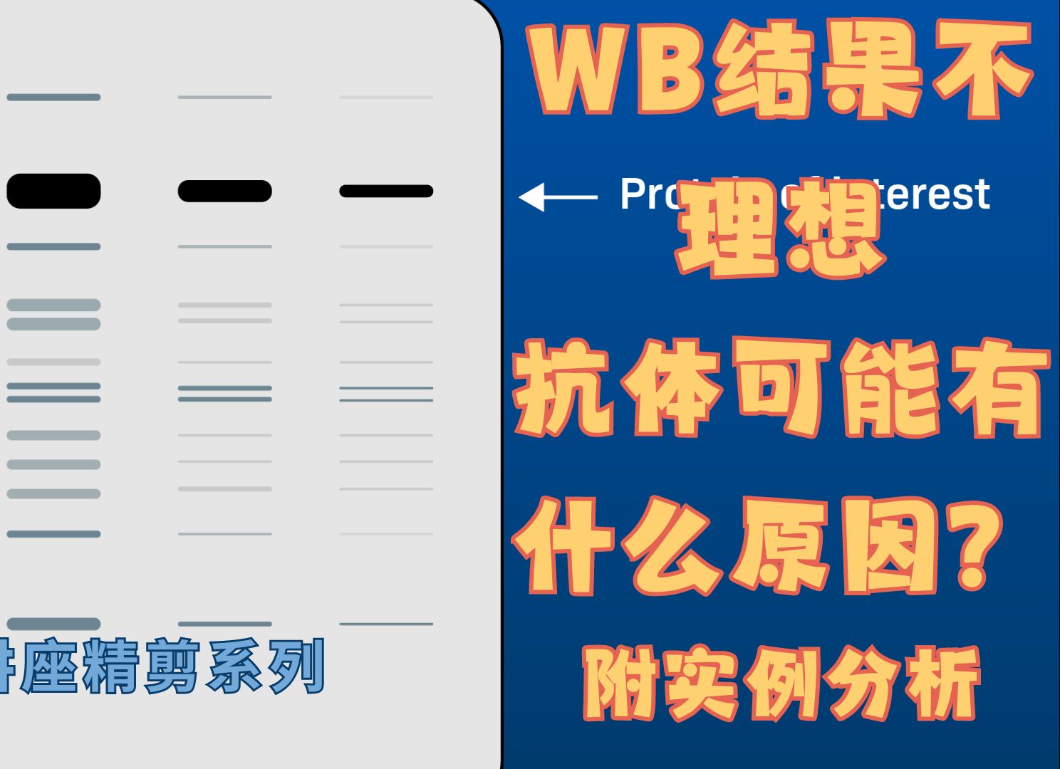 【WB讲座CUT】WB结果不理想,抗体可能有什么原因?附实例分析哔哩哔哩bilibili