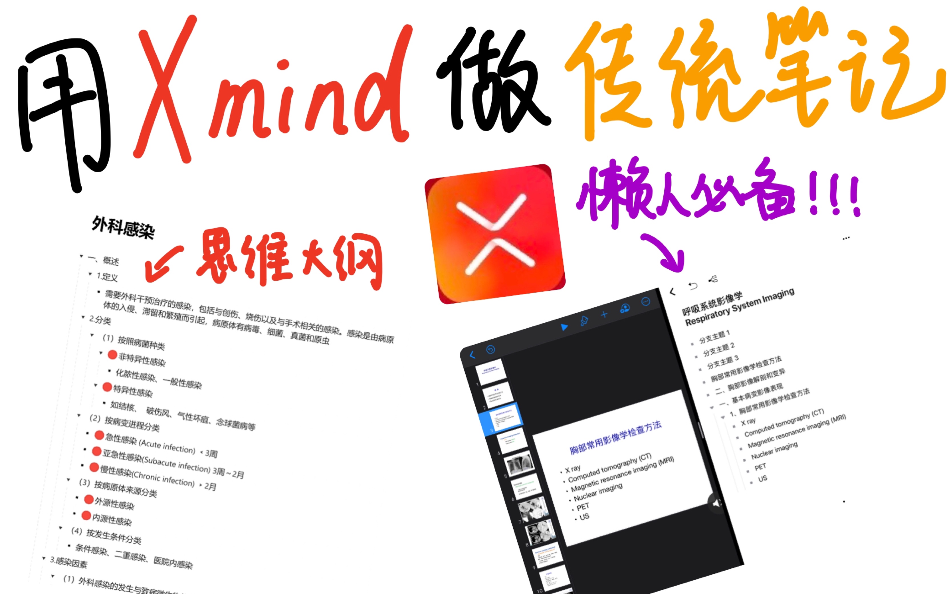 [图]医学生如何用xmind思维大纲简单、快速记笔记｜懒人必备，解放双手｜“传统笔记”爱好者一定会喜欢！