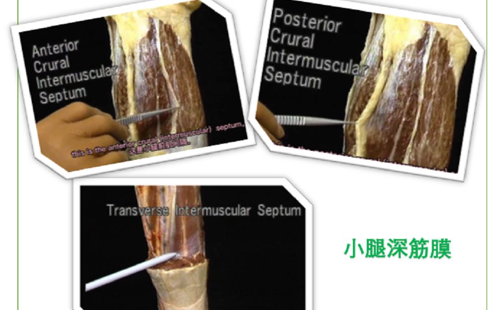 [图]【双语字幕】艾氏解剖学-小腿深筋膜（下肢25）