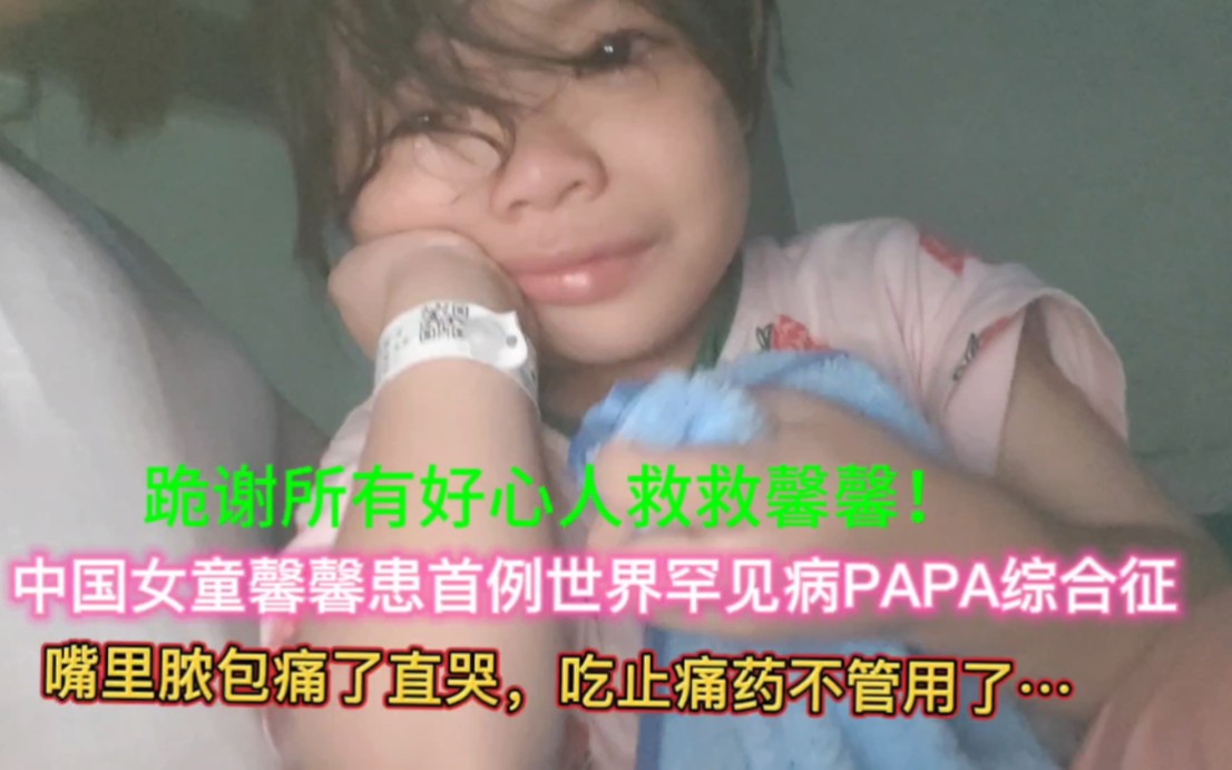 中国罕见病女孩馨馨患PAPA综合征7年多,每天靠吃药打针控制病情疼痛!无奈大小手术做了10多次,真让人心疼……哔哩哔哩bilibili