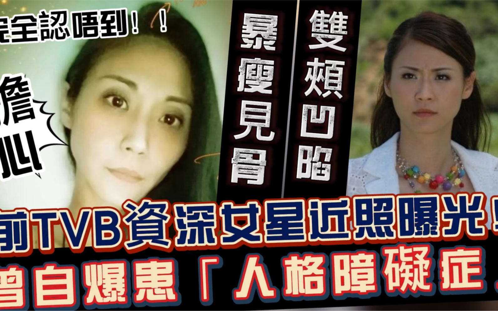 暴瘦见骨!TVB资深女星近照曝光惹人担心,双颊凹陷患人格障碍症哔哩哔哩bilibili