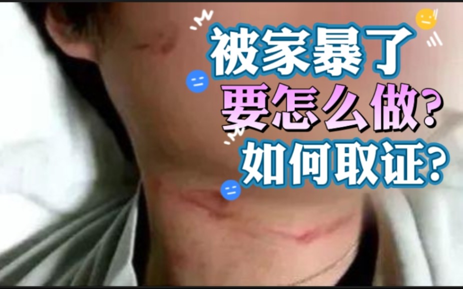 被家暴了,要怎么办?如何取证?哔哩哔哩bilibili