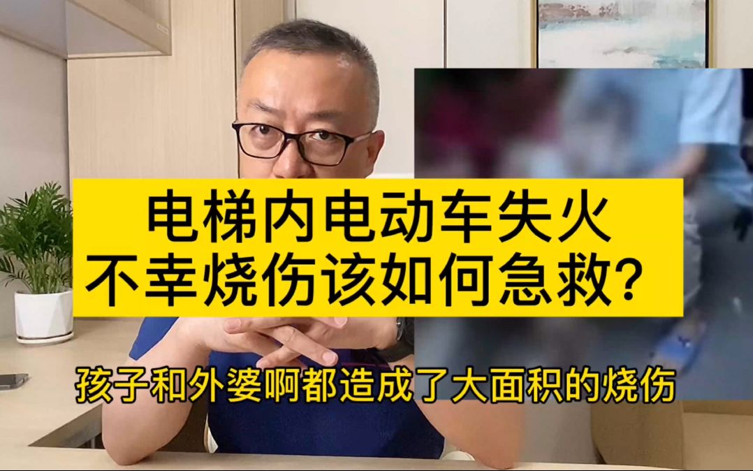 不小心被烫伤第一时间该如何急救?这个急救知识你要学会!哔哩哔哩bilibili