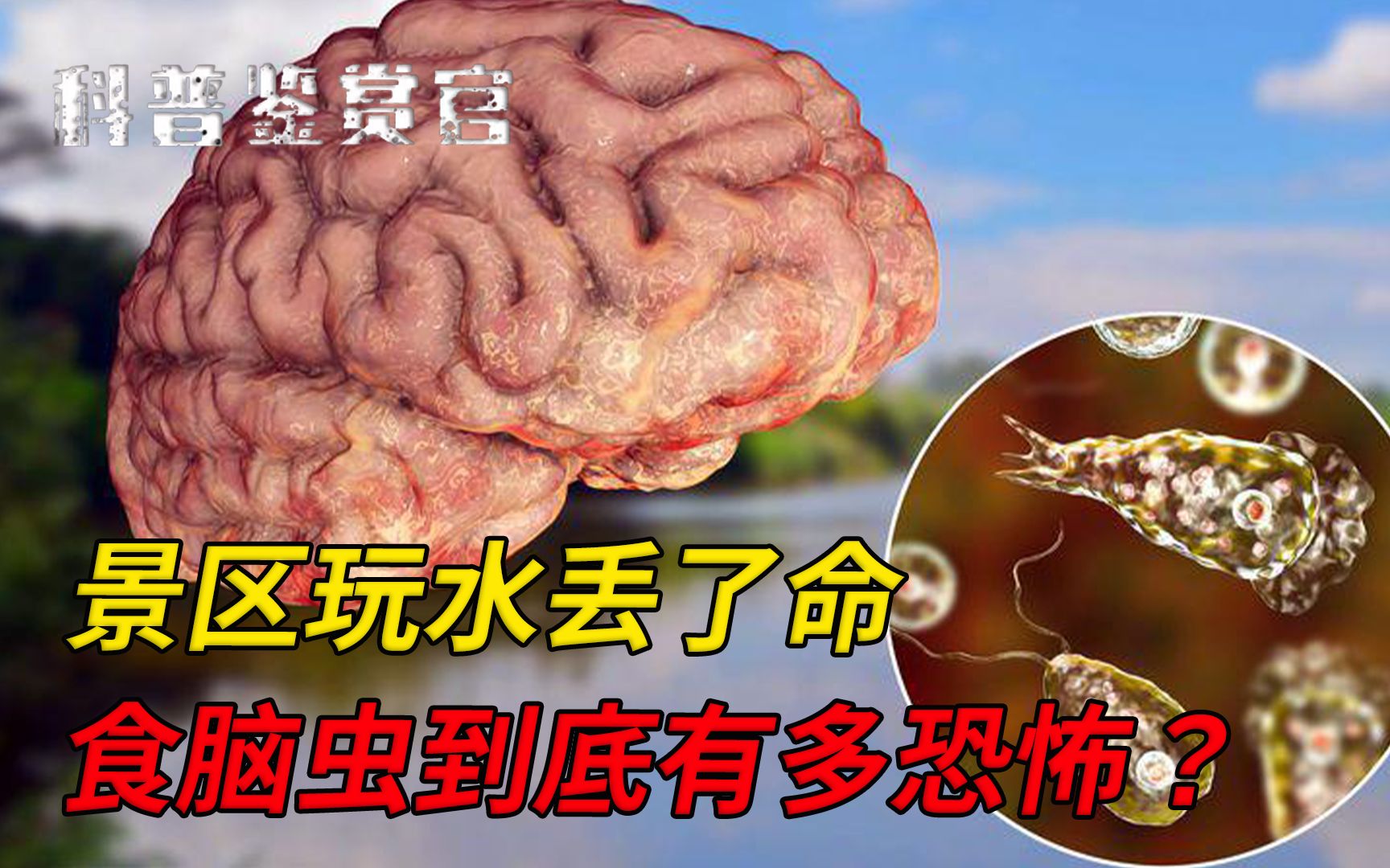 每年夏天出没!“夺命”食脑虫,如何一步步啃食人的大脑?哔哩哔哩bilibili