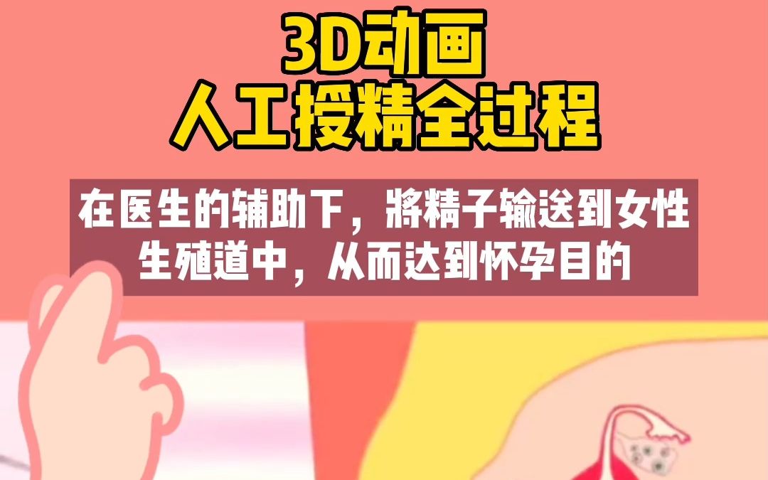 人工授精全过程哔哩哔哩bilibili