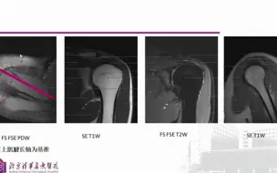 Download Video: 49.肩部MRI诊断-影像诊断思维训练营系列3