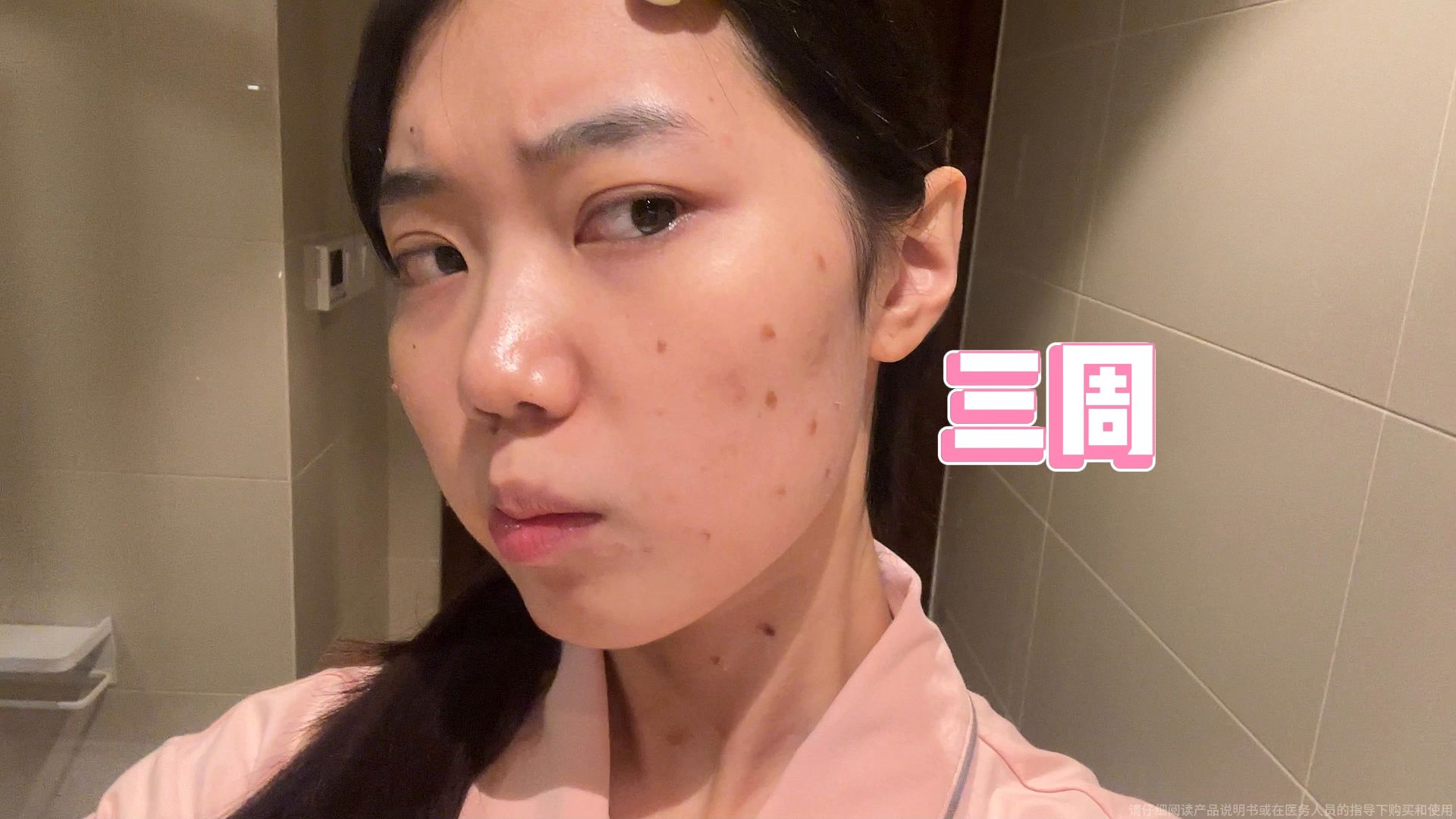 别等到"疣"开"花"了,才知道自己得hpv了!