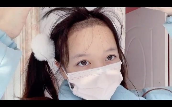 扎双马尾扎多了真的两边的头发会秃!害.#秃头少女