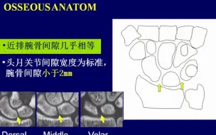 Download Video: 8.腕关节撞击的影像评估-骨肌影像诊断思维系列1