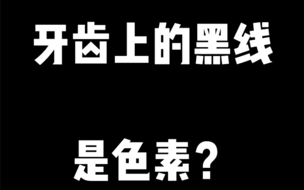 牙齒上的黑線,是色素?還是蛀牙?