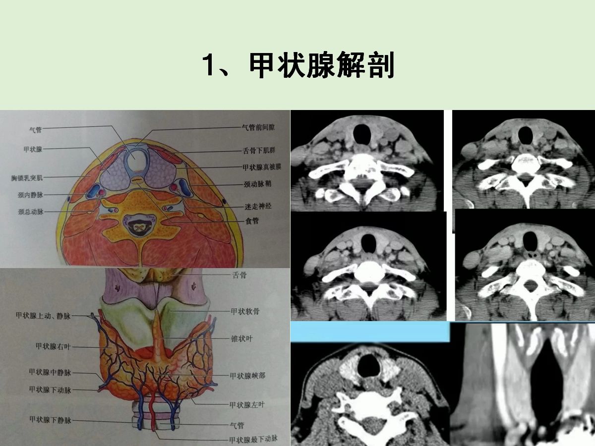 甲狀腺解剖與常見疾病影像診斷