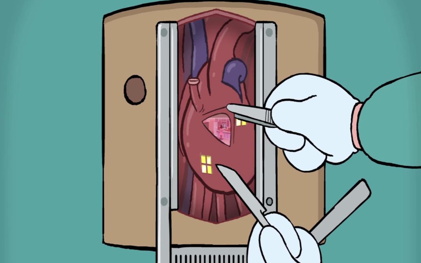 一部国外神脑洞奥斯卡动画,医生给病人做心脏手术,会发生什么呢?