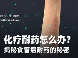 Download Video: 中国科学家发现食管癌对化疗耐药的新机制