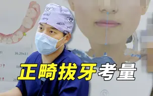 Descargar video: 拔牙禁忌症的患者拔牙做矫正了，接下来该如何治疗？