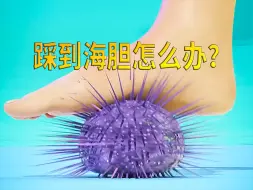 Download Video: 踩到海胆该怎么办？