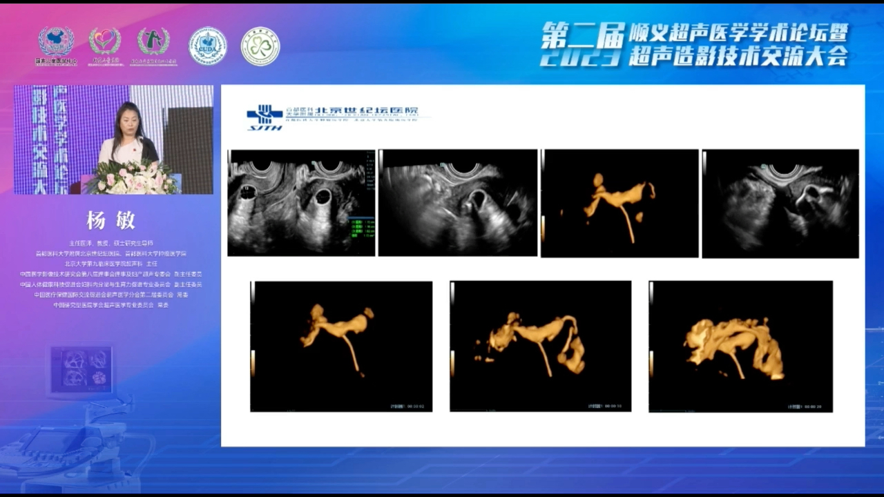 《子宫输卵管超声造影临床应用》杨敏教授,2023超声造影技术交流大会哔哩哔哩bilibili