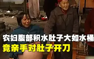 Video herunterladen: 53岁农妇怀孕一年多，肚子大如水桶，农妇狠心对肚子开刀