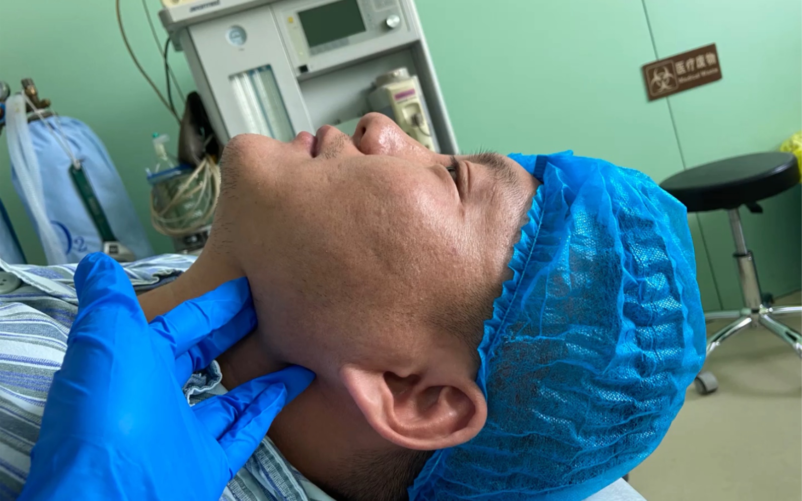 谁说男孩子不能磨骨,颧骨下颌角劈外板