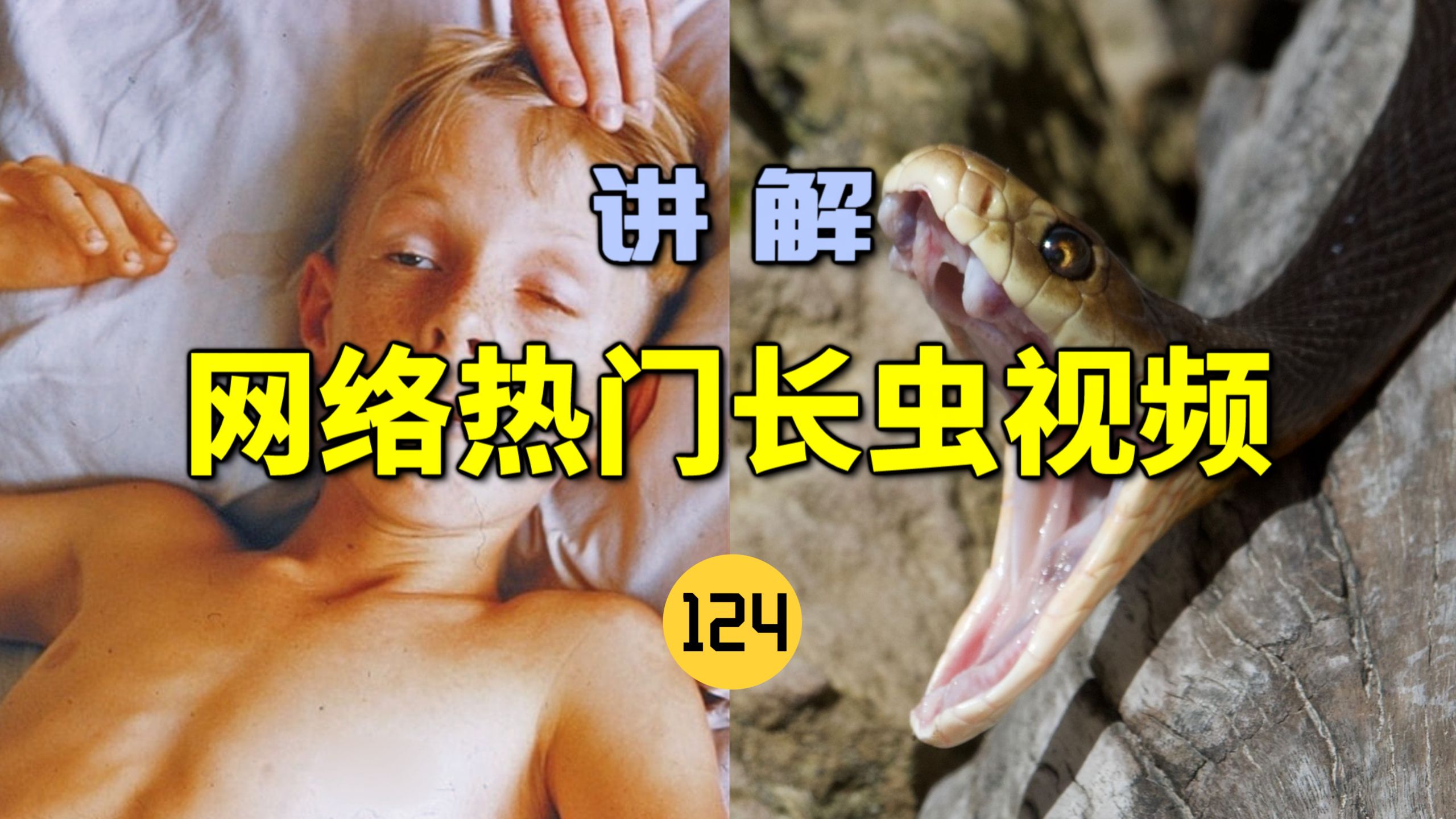网络热门长虫视频(124)十岁男孩被太攀蛇咬伤！生命垂危险丧命！