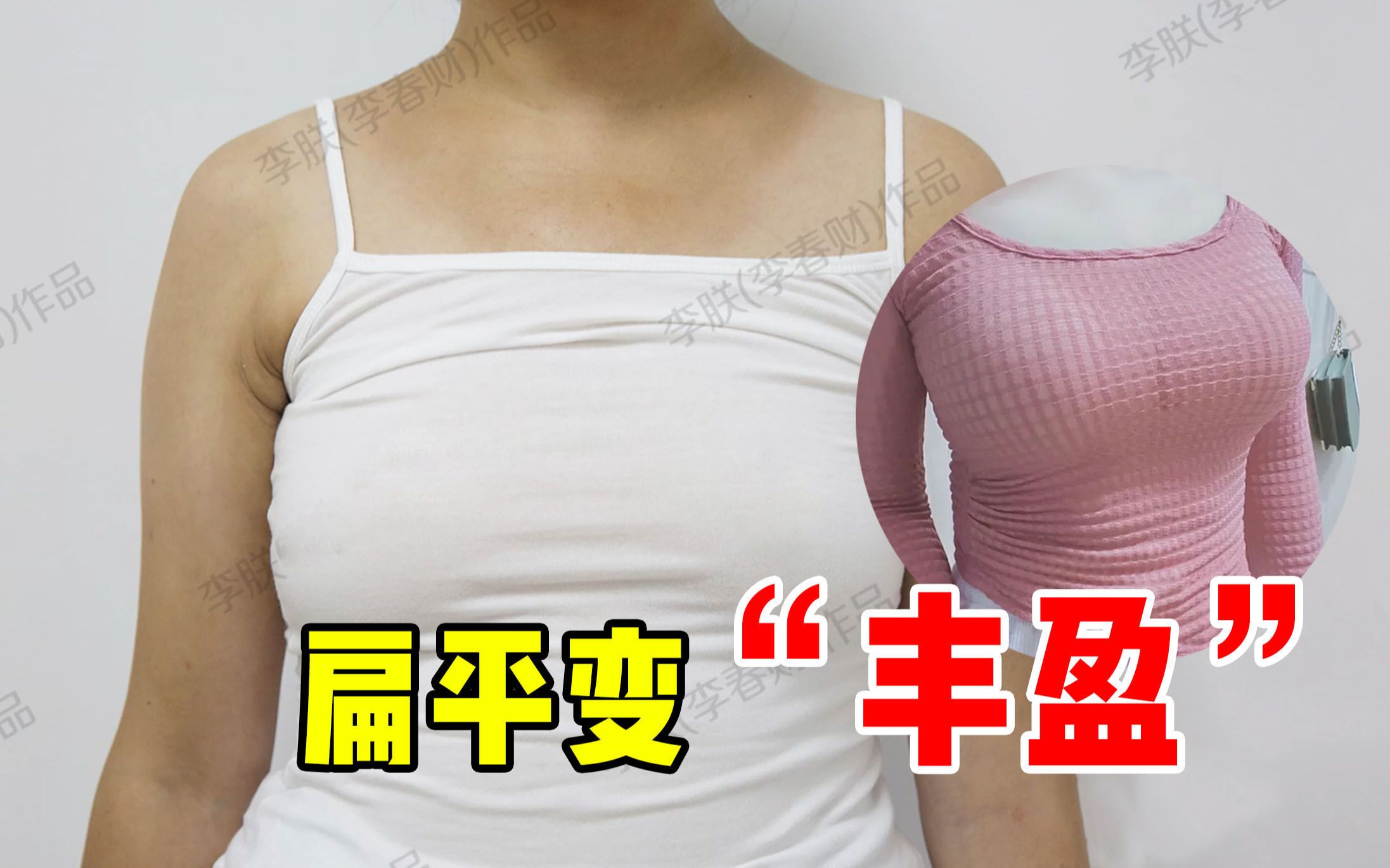 【李朕】43岁山东来做自体脂肪丰胸,术后3个月,扁平变"丰盈"