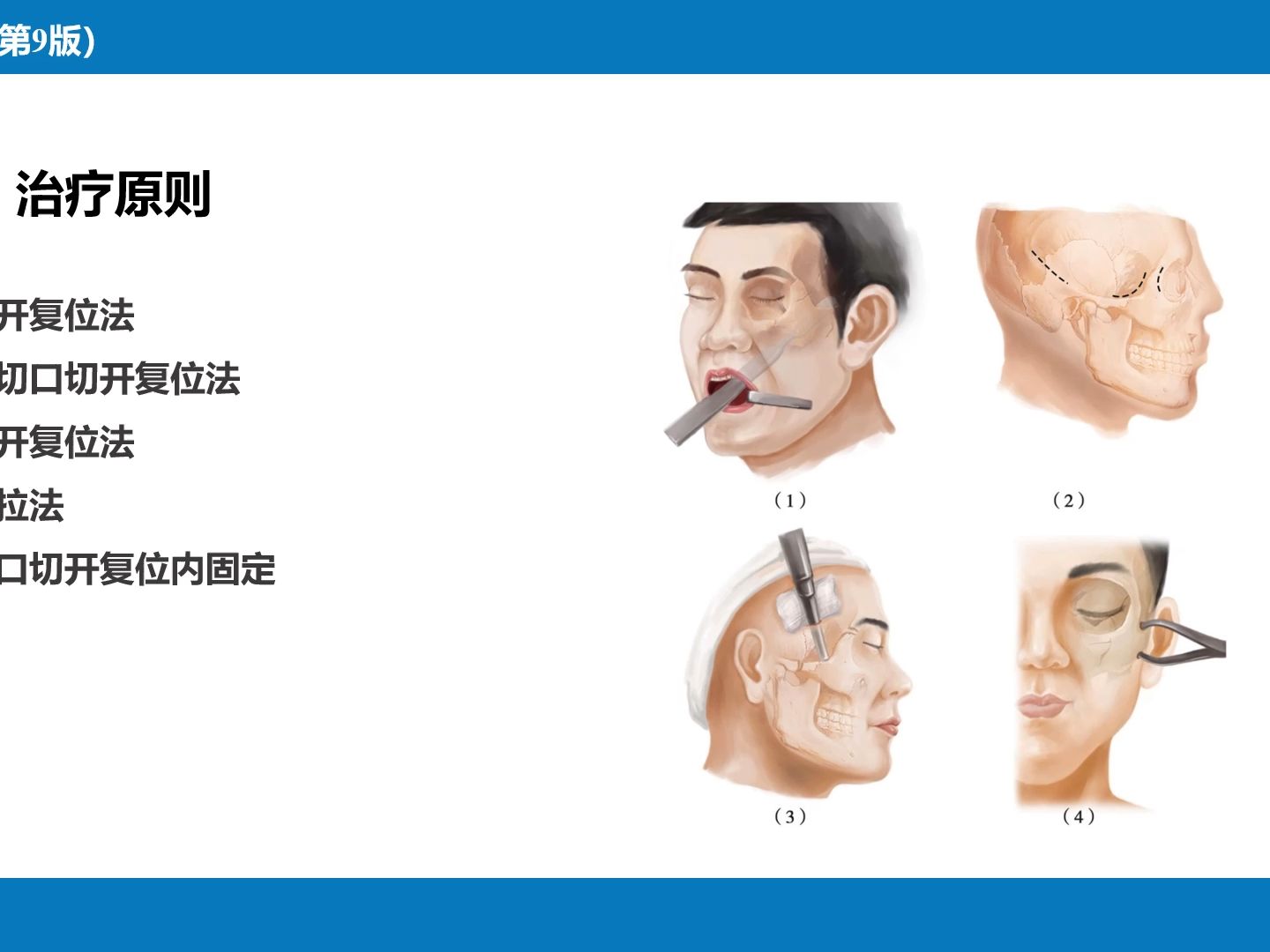 口腔頜面部損傷ppt