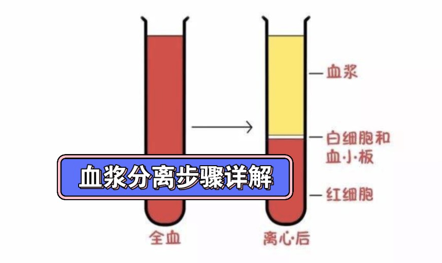 血浆分离步骤详解哔哩哔哩bilibili