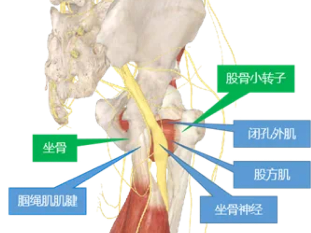 坐骨股骨撞击下肢放射痛处理哔哩哔哩bilibili