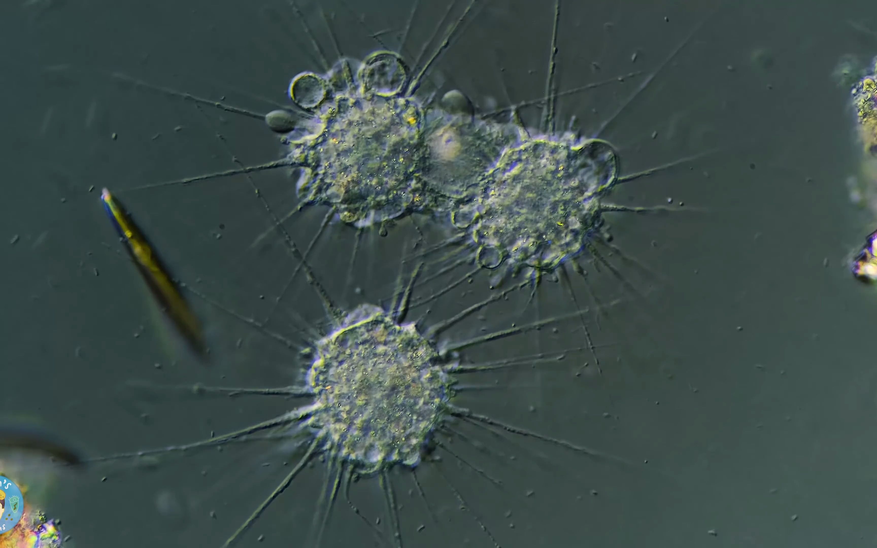 【4k】太阳虫:温暖的死亡杀手 heliozoans the sun animalcules