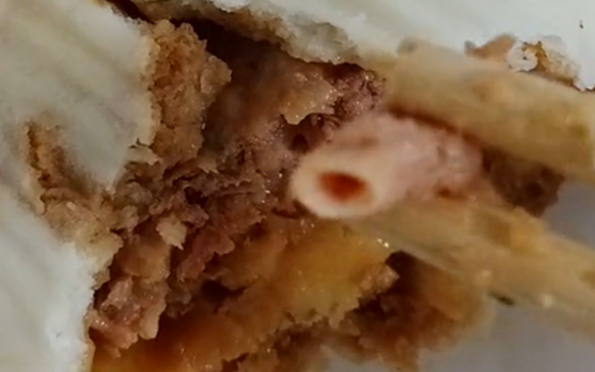 男子吃肉包子吃到血管,质疑商家使用淋巴肉,网友:黑心商家!