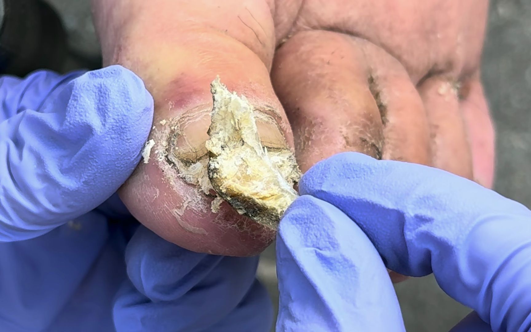 指甲上覆盖着一层黑泥,硬指甲很脏